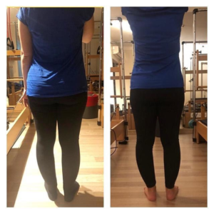 Before and after weight loss progress — fitness transformation results